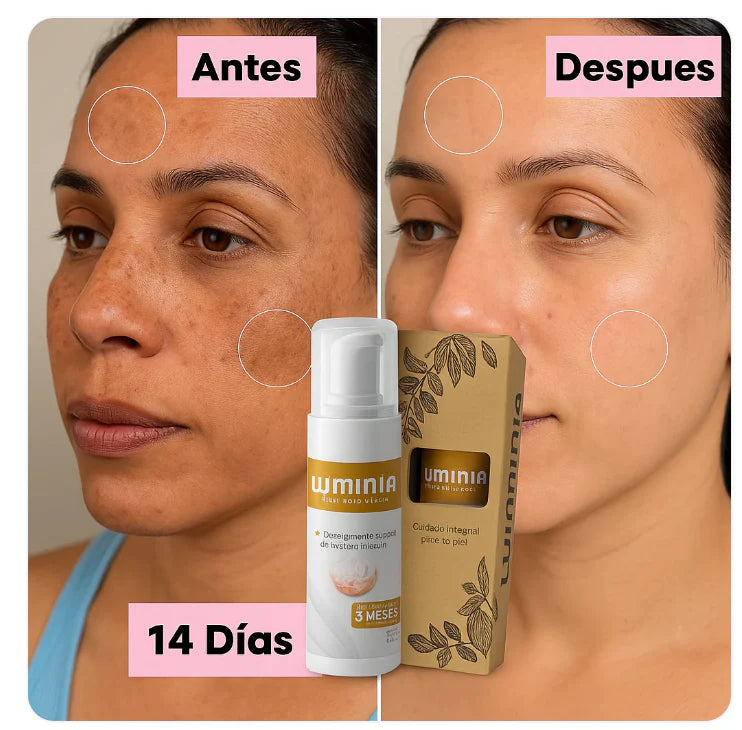 DESPIGMENTANTE FACIAL NIACINAMIDA LUMINI