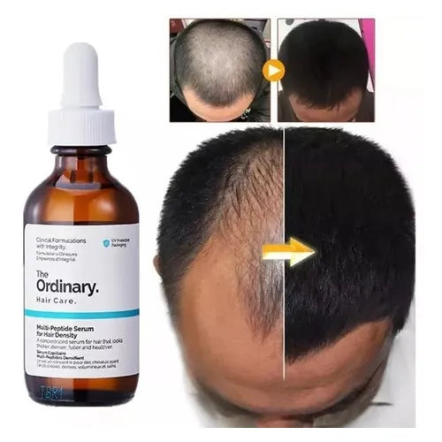 The Ordinary Multi-Peptide Serum for Hair Density